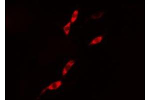 ABIN6276418 staining 293 cells by IF/ICC. (Caspase 1 Antikörper  (C-Term))