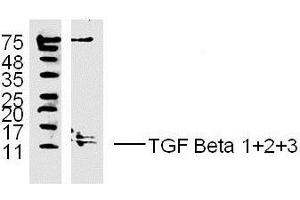 MDA-MB-231 lysates probed with TGF Beta 1+2+3 Polyclonal Antibody, unconjugated  at 1:300 overnight at 4°C followed by a conjugated secondary antibody at 1:10000 for 60 minutes at 37°C. (TGF-beta Antikörper  (AA 301-350))
