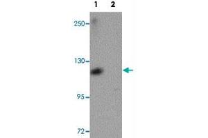Western blot analysis of ATP11A in K-562 cell lysate with ATP11A polyclonal antibody  at 1 ug/mL in (1) the absence and (2) the presence of blocking peptide. (ATP11A Antikörper  (N-Term))