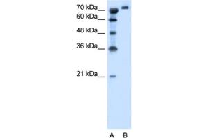 Western Blotting (WB) image for anti-Solute Carrier Family 6, Member 18 (SLC6A18) antibody (ABIN2462786)