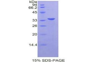 SDS-PAGE analysis of Rat STAT6 Protein.