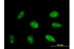 Immunofluorescence of purified MaxPab antibody to EXOSC3 on HepG2 cell. (EXOSC3 Antikörper  (AA 1-275))