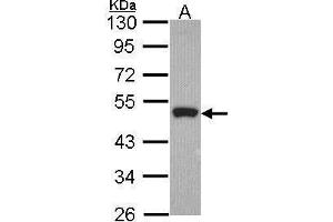 WB Image Sample (30 ug of whole cell lysate) A: Hela 10% SDS PAGE Peripherin antibody antibody diluted at 1:1000 (Peripherin Antikörper)