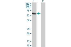 Western Blot analysis of LCK expression in transfected 293T cell line by LCK monoclonal antibody (M11), clone 3H5. (LCK Antikörper  (AA 1-100))