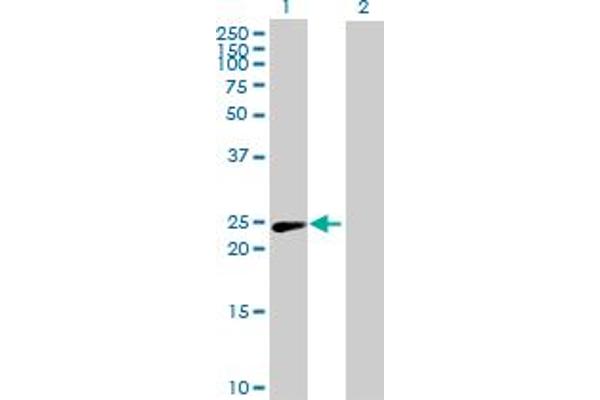 PSMD10 Antikörper  (AA 1-226)