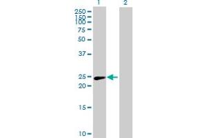 Western Blot analysis of PSMD10 expression in transfected 293T cell line by PSMD10 MaxPab polyclonal antibody. (PSMD10 Antikörper  (AA 1-226))