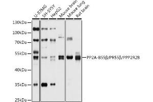 Western blot analysis of extracts of various cell lines, using PP2A-B55β/PR55β/PP2A-B55β/PR55β/PPP2R2B antibody (ABIN6132513, ABIN6146087, ABIN6146088 and ABIN6214771) at 1:1000 dilution. (PPP2R2B Antikörper  (AA 160-260))
