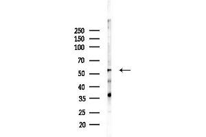 Western blot analysis of lysates from PC12 cells(LPS, 4h treatment), using ATPB Antibody at 1/1000 dilution.