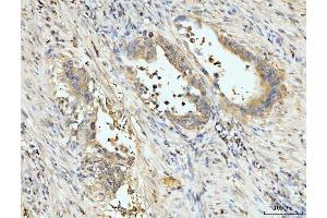 IHC analysis of PDLIM7 using anti-PDLIM7 antibody (ABIN7601048). (PDLIM7 Antikörper  (AA 275-457))