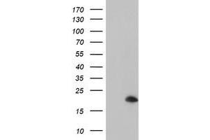 Western Blotting (WB) image for anti-ADP-Ribosylation Factor-Like 5B (ARL5B) antibody (ABIN1496721)