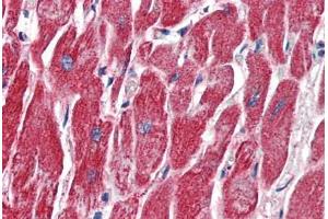 Anti-MMP14 antibody IHC of human heart. (MMP14 Antikörper  (AA 160-173))