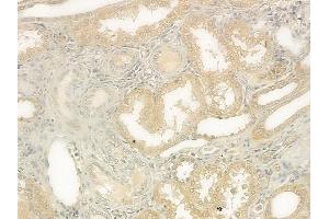 ABIN6263174 and ABIN6273136 at 1/100 staining human normal kidney tissue by IHC-P. (DIAPH1 Antikörper  (N-Term))