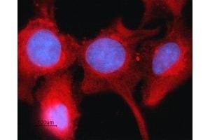 Expression of Connexin-43 in rat intestinal epithelial IEC-6 cells - Immunocytochemical staining of fixed and permeabilized rat intestinal epithelial IEC-6 cells. (Connexin 43/GJA1 Antikörper  (C-Term, Intracellular))
