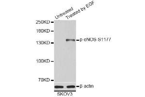 Western blot analysis of extracts of SKOV3 cells, using Phospho-eNOS-S1177 antibody (ABIN5995597). (ENOS Antikörper  (pSer1177))