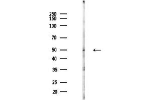 anti-KIAA1045 (KIAA1045) antibody