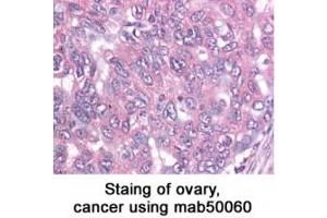 Image no. 2 for anti-Baculoviral IAP Repeat-Containing 5 (BIRC5) antibody (ABIN363214) (Survivin Antikörper)