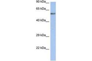 Image no. 1 for anti-Zinc Finger Protein 513 (ZNF513) (AA 71-120) antibody (ABIN6742217)