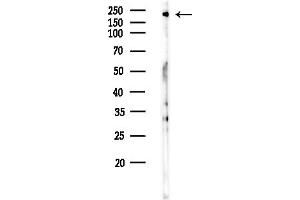 anti-B-Cell CLL/lymphoma 9-Like (BCL9L) (pSer915) antibody