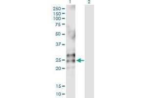 Western Blot analysis of RNASE2 expression in transfected 293T cell line by RNASE2 MaxPab polyclonal antibody. (RNASE2 Antikörper  (AA 1-161))