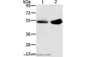 Western blot analysis of Human placenta and plasma tissue, using SLC13A3 Polyclonal Antibody at dilution of 1:200 (SLC13A3 Antikörper)