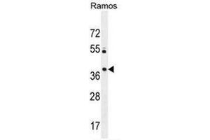 MGC24975 Antibody (C-term) western blot analysis in Ramos cell line lysates (35µg/lane). (PRR22 Antikörper  (C-Term))