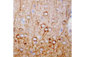 Anti-CaMKK antibody, IHC(P): Rat Brain Tissue (CAMKK1 Antikörper  (N-Term))