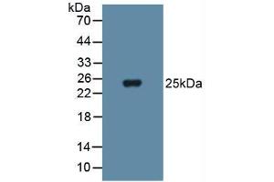 Western blot analysis of Human Blood Cells. (SOD3 Antikörper  (AA 19-240))