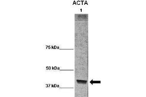 WB Suggested Anti-ACTA1 Antibody  Positive Control: Lane 1:541 µg term baboon muscle homogenate Primary Antibody Dilution: 1:0666Secondary Antibody: Anti-rabbit-HRP Secondry  Antibody Dilution: 1:0200Submitted by: Cynthia Blanco, University of Texas Health Science Center (Actin Antikörper  (C-Term))