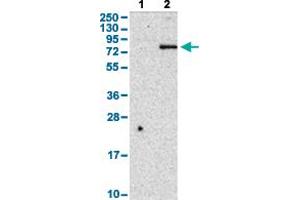 Western Blot analysis with CD248 polyclonal antibody . (CD248 Antikörper  (AA 375-457))