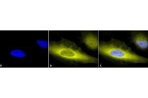 Immunocytochemistry (ICC) image for anti-Ubiquitin (Ub) antibody (ABIN361831)