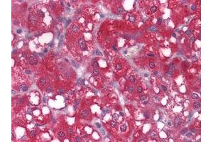 Immunohistochemistry (IHC) image for anti-Wingless-Type MMTV Integration Site Family, Member 1 (WNT1) antibody (ABIN969458)