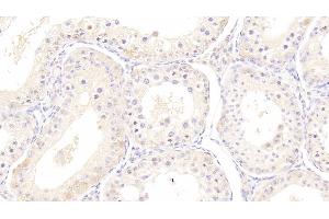 Detection of HSPA1B in Bovine Testis Tissue using Monoclonal Antibody to Heat Shock 70 kDa Protein 1B (HSPA1B) (HSPA1B Antikörper  (AA 1-641))