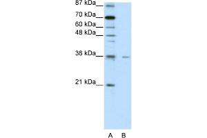 WB Suggested Anti-FOXQ1 Antibody Titration:  2.