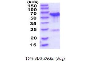 SDS-PAGE (SDS) image for TBC1 Domain Family, Member 22B (TBC1D22B) (AA 1-505) protein (His tag) (ABIN6387596) (TBC1D22B Protein (AA 1-505) (His tag))