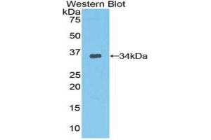 Western Blotting (WB) image for anti-3-phosphoinositide Dependent Protein Kinase-1 (PDPK1) (AA 83-338) antibody (ABIN3205317) (PDPK1 Antikörper  (AA 83-338))