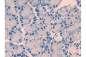 Detection of CRF in Rat Pancreas Tissue using Polyclonal Antibody to Corticotropin Releasing Factor (CRF) (CRH Antikörper  (AA 39-187))