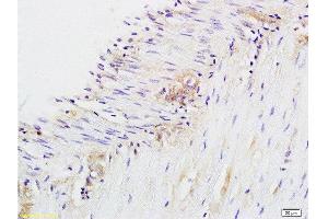 Formalin-fixed and paraffin embedded rat colitis labeled with Anti-CD28 Polyclonal Antibody, Unconjugated  at 1:200 followed by conjugation to the secondary antibody and DAB staining.