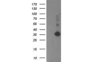 Western Blotting (WB) image for anti-Sirtuin 5 (SIRT5) antibody (ABIN1500935) (SIRT5 Antikörper)