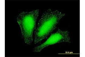 Immunofluorescence of monoclonal antibody to ATOX1 on HeLa cell. (ATOX1 Antikörper  (AA 1-68))