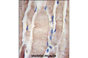 Formalin-fixed and paraffin-embedded human skeletal muscle tissue reacted with PHPT1 polyclonal antibody  , which was peroxidase-conjugated to the secondary antibody, followed by DAB staining.