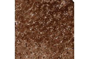Immunohistochemical staining of human liver with ZNF862 polyclonal antibody  shows strong cytoplasmic positivity in hepatocytes.