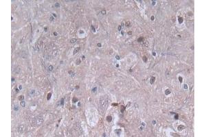 DAB staining on IHC-P; Samples: Rat Spinal cord Tissue (PF4 Antikörper  (AA 30-105))