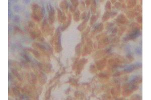 Detection of ITLN1 in Mouse Testis Tissue using Polyclonal Antibody to Intelectin 1 (ITLN1) (ITLN1/Omentin Antikörper  (AA 28-270))