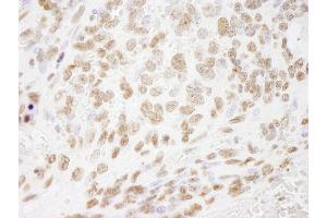 Immunohistochemistry (IHC) image for anti-Histone H3 (H3) (C-Term) antibody (ABIN7448974) (Histone 3 Antikörper  (C-Term))