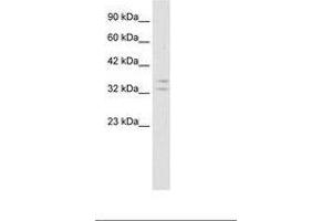 POU1F1 anticorps  (AA 75-124)