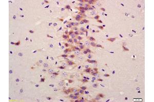 Formalin-fixed and paraffin embedded mouse brain labeled with Anti-LC3A/B Polyclonal Antibody, Unconjugated (ABIN1386290) at 1:200 followed by conjugation to the secondary antibody and DAB staining (LC3A / LC3B (AA 31-121) Antikörper)