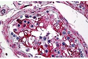 Immunohistochemistry (Formalin-fixed Paraffin-embedded Sections) (IHC (fp)) image for anti-Annexin A5 (ANXA5) (AA 1-321) antibody (ABIN626018)