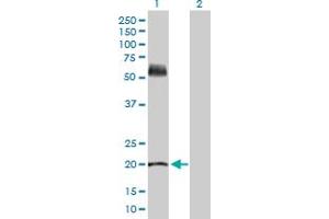 Western Blot analysis of KRT81 expression in transfected 293T cell line by KRT81 MaxPab polyclonal antibody.