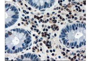 Immunohistochemical staining of paraffin-embedded colon using anti-APOM (ABIN2452530) mouse monoclonal antibody.