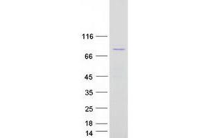 Validation with Western Blot (BMX Protein (Transcript Variant 1) (Myc-DYKDDDDK Tag))